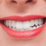 今ならまだ良くなるかも!?歯槽膿漏の症状と治療方法について詳しく解説!